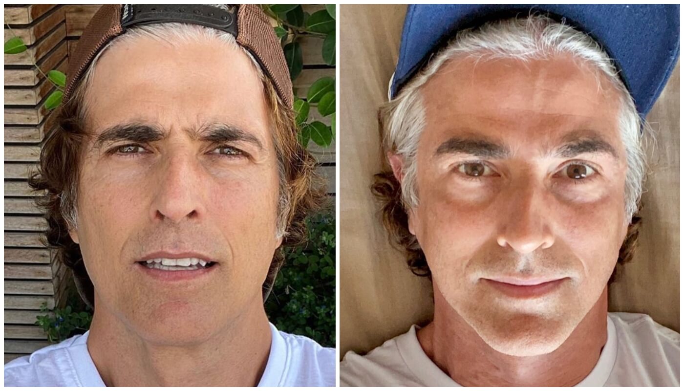 erros comuns ao cuidar de cabelo grisalho